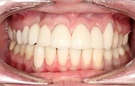 Smile with flawless healthy teeth and gums