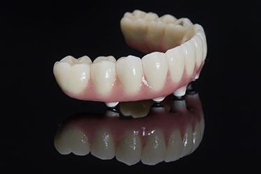Implant-retained denture sitting by itself on reflective black surface
